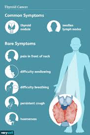 thyroid cancer signs symptoms and