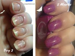 white spots in nails sue s pure nail