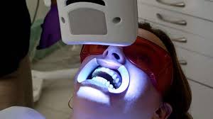 is uv teeth whitening safe colgate