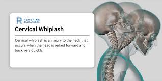 cervical whiplash nj s top orthopedic