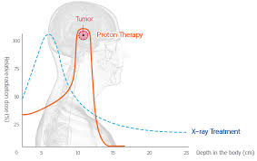 how it works what is proton therapy