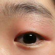 an eye infection from makeup