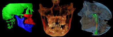 dental radiology diagnostics cone