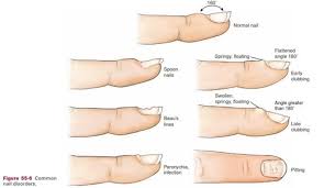 nail diseases disorders 113 1