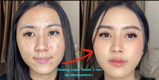 murah ini 3 bedak acne yang co