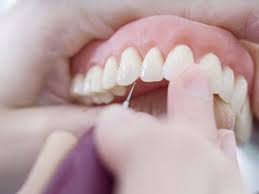 4 common denture problems and how to
