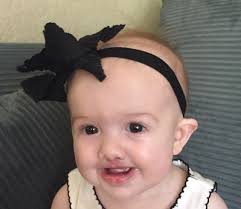 Genetic Syndrome Causes Cleft Lip, Palate in Sisters - CHOC - Children's  health hub