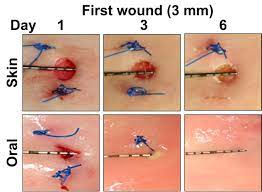 why mouth wounds heal faster than skin