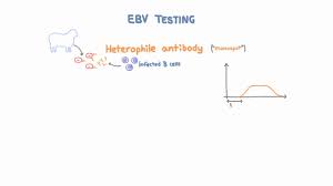 Epstein Barr Virus Ebv Diagnosis And Testing