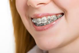 Even if the patient is able to wear the retainer without any discomfort, it doesn't necessarily follow that the teeth will be restored to their corrected position by. Life After Braces What You Should Know About Retainers Wear And Care Fort Lee Family Dental Fort Lee New Jersey