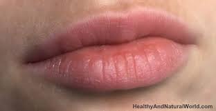 ps on lips causes and top natural