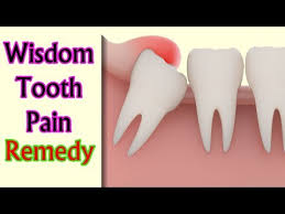 For severe pain, take the tablets prescribed as directed. Home Remedies For Wisdom Tooth Pain Wisdom Tooth Pain In Jaw Youtube