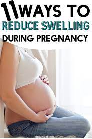 reduce swelling during pregnancy