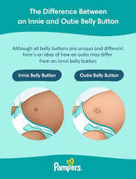outie belly ons in es causes