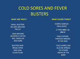 ppt cold sores and fever blisters