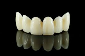 Porcelain Crowns and Bridges - Cosmetic Dentistry