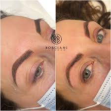 permanent makeup tattoo removal