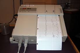 Cardiotocography Wikipedia