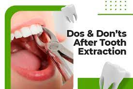 tooth extraction after care