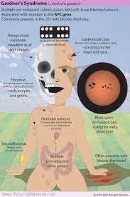 pre malignant colonic grepmed