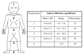 5 Kramer Scale Jaundice In Newborn Bilirubin Level Chart