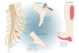 herniated disc l5 s1 guide treatment