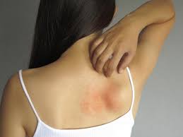 skin problems allergies and its care