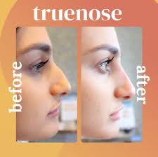 true nose a risk free confidence