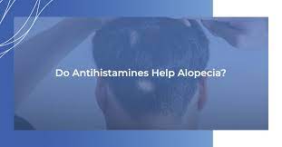 do antihistamines help alopecia rhrli