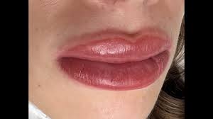 improve lip scars with cal