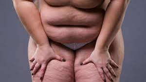Fat-Shaming: Warum fühlen wir uns von Fetten so provoziert? | STERN.de