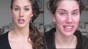 celebrity for acne makeup tutorials