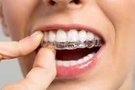 How Invisalign Is Changing Smiles One Smile At a Time - Medland Orthodontics