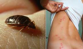 Bed Bugs Are On The Rise 10 Tips To