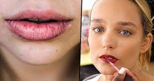 dry lips after applying matte lipstick