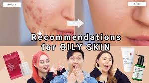 must have korean skincare for oily skin