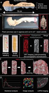 3d Imaging Of Human Organs With