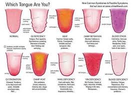 Traditional Chinese Medicine Tongue Health Chart Tongue