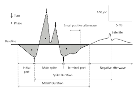 motor unit action potential duration