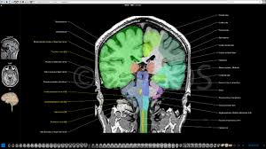 A brain model with arteries and coloured sections, for basic anatomy education. Brain Atlas Of Human Anatomy With Mri
