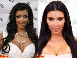 kim kardashian plastic surgery journey