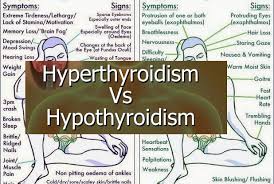 Hyperthyroidism Vs Hypothyroidism Hyperthyroidism And