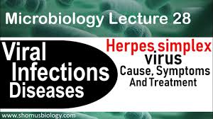herpes simplex virus microbiology