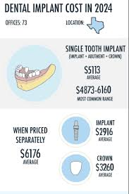 dental implant cost in 2024 full and
