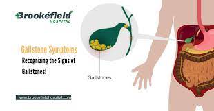 gallstone symptoms recognizing the