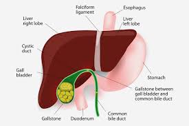 Gallstones In Children Everything You Need To Know