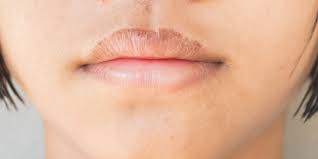 causes of dry and ed lips beware