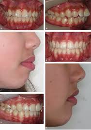 orthodontic treatment planning can we