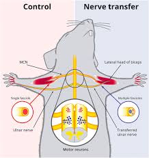 1 product name+ price : Peripheral Nerve Transfers Change Target Muscle Structure And Function Science Advances