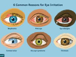 top 6 reasons for eye irritation